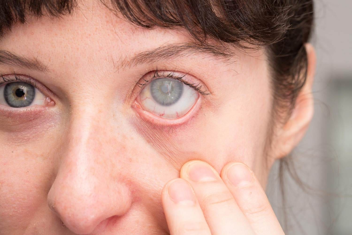 Glaucoma Specialist in Mumbai
