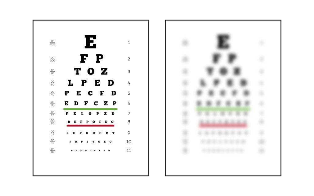 Lasik Specialist in Mumbai