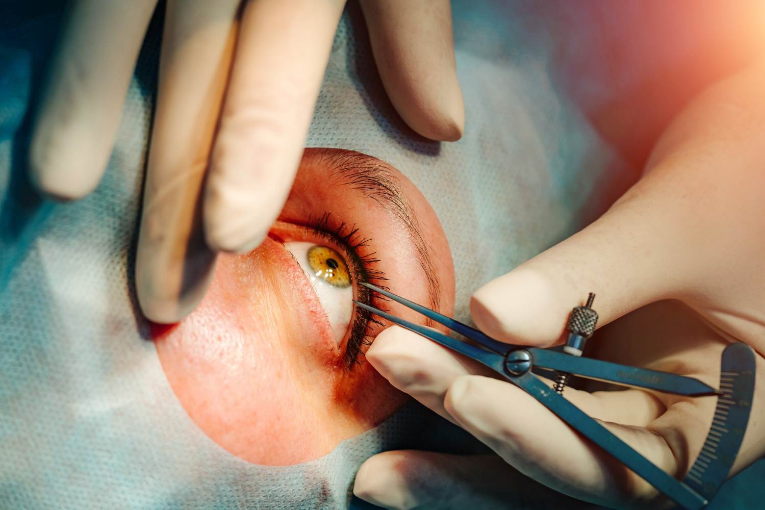 Vitrectomy Surgery in Mumbai