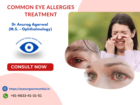 Eye Specialist in Goregaon - Eye Allergies and Treatment explained