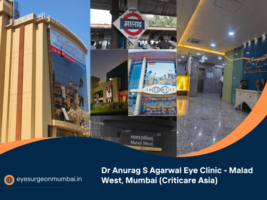 eye specialist Malad