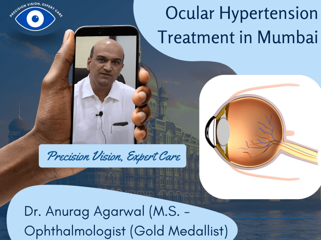 Ocular Hypertension Treatment