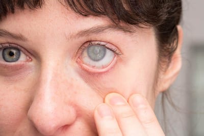 Glaucoma Specialist in Mumbai