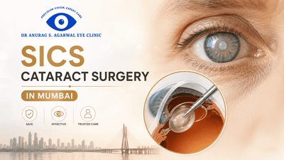 SICS Cataract Surgery